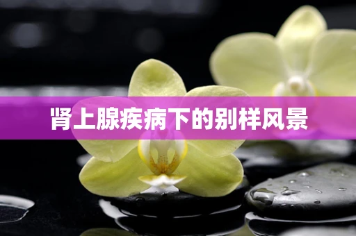 肾上腺疾病下的别样风景
